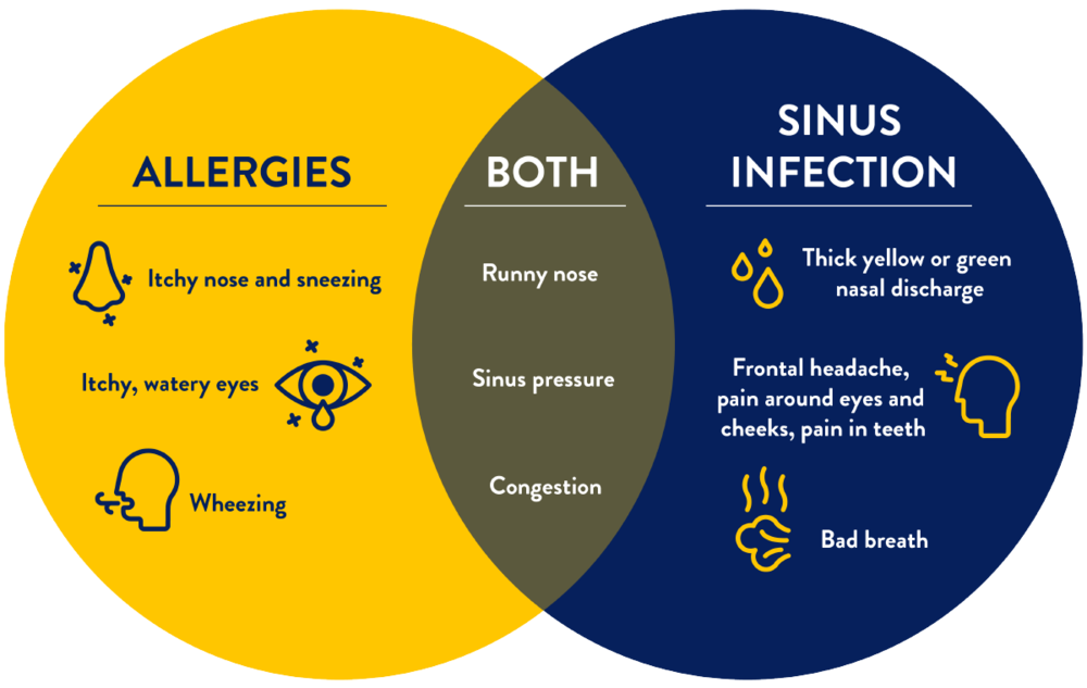 Bad sales sinus infection
